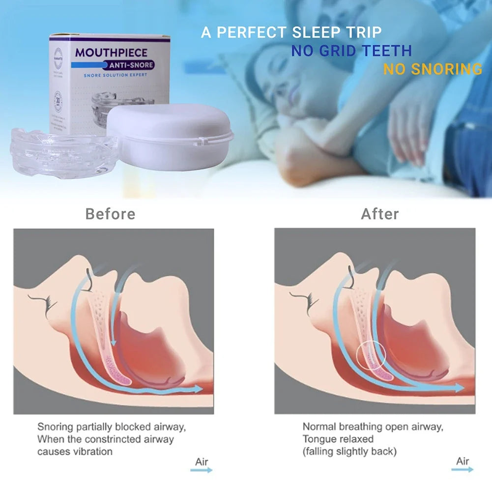 Portable Mouth Guard with Storage Box – Lightweight & Reusable