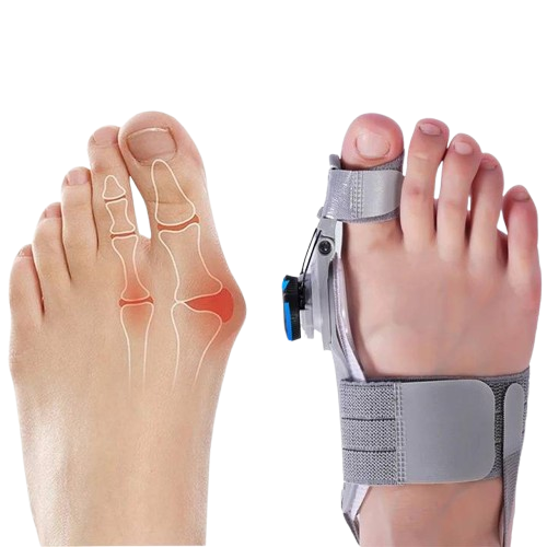 Bunion Corrector Toe Spacer Adjustable Orthotic Toe Realignment Fall 2026 Comfort and Pain Relief