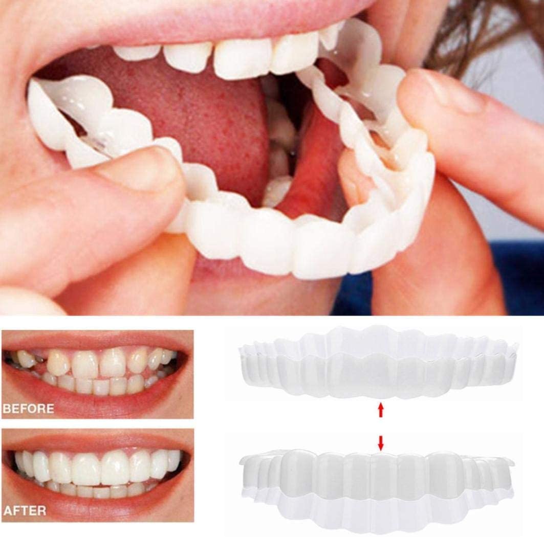 Smile Veneers Upper And Lower Instant Cover For All Day