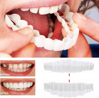 Smile Veneers Upper And Lower Instant Cover For All Day