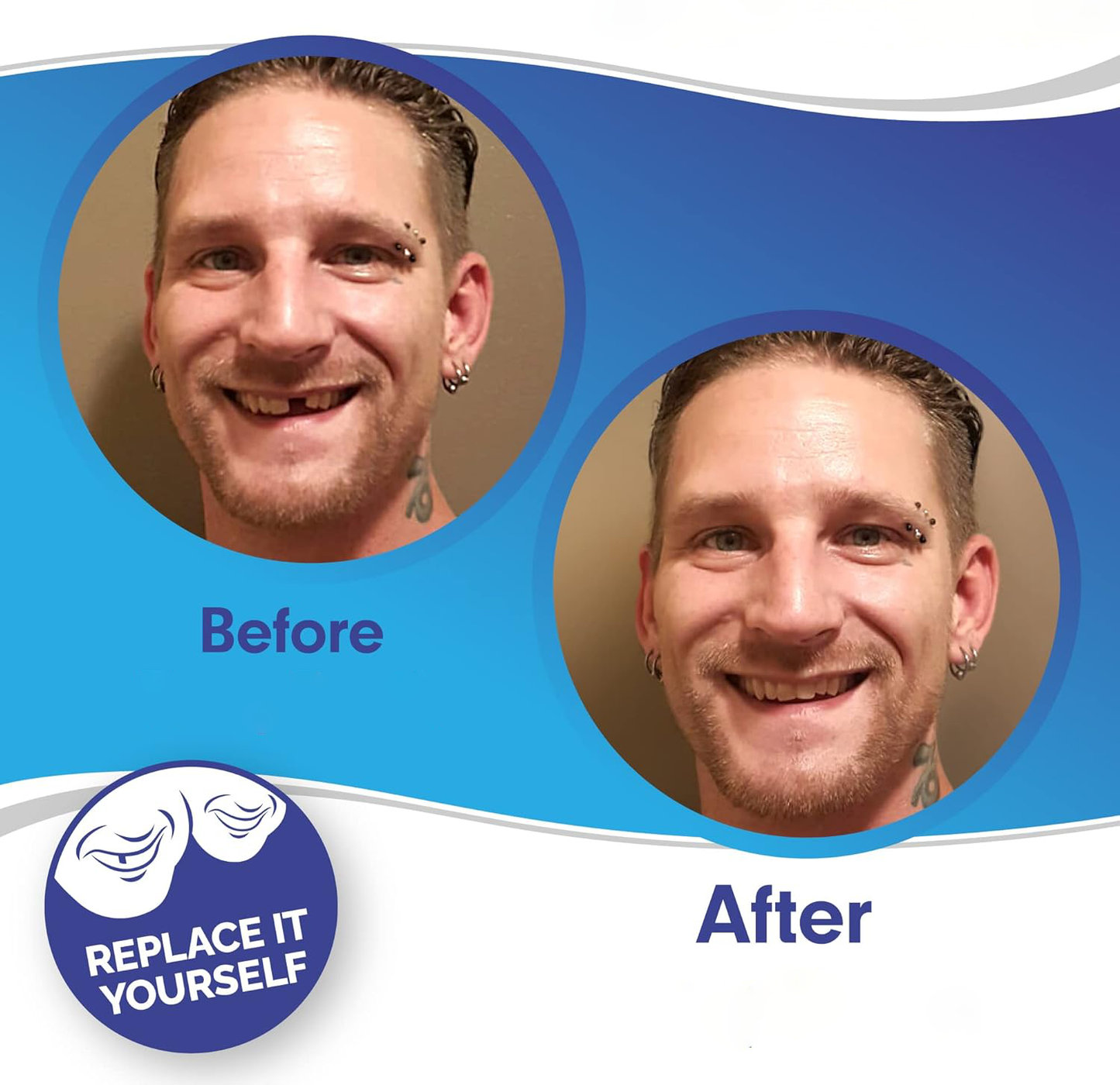 Smile Veneers Upper And Lower Instant Cover For All Day