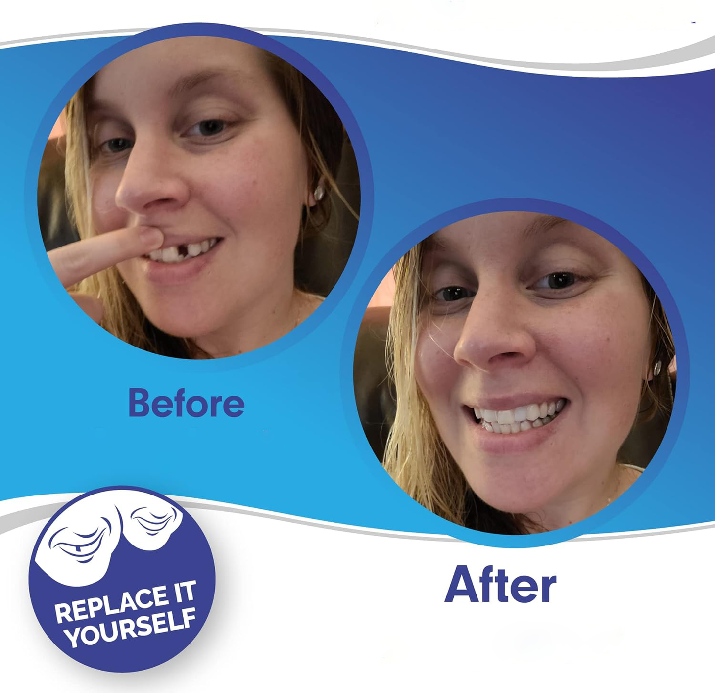 Smile Veneers Upper And Lower Instant Cover For All Day