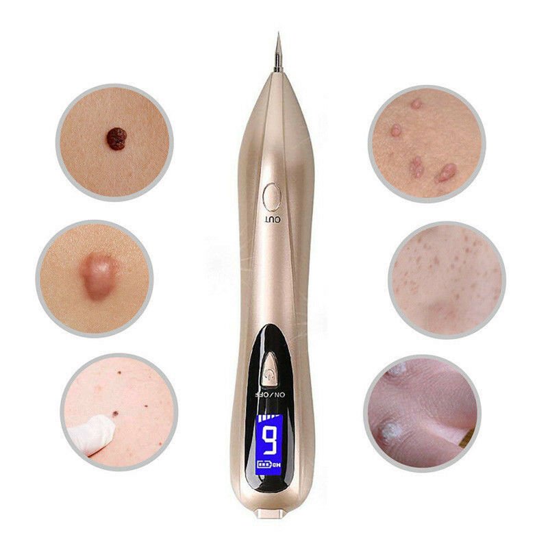 Mole Remover Pen At Home Skin Tag Removal Painless Fast
