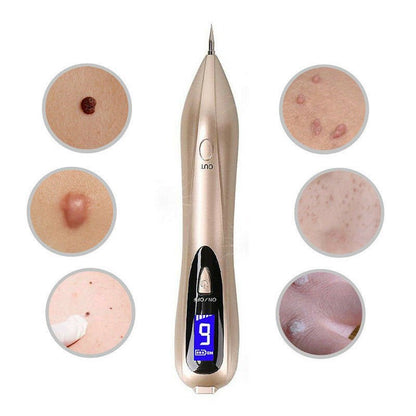 Mole Remover Pen At Home Skin Tag Removal Painless Fast