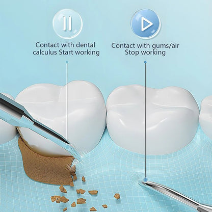 Ultrasonic Scaling Wand: Efficient and safe tooth cleaning at home with LED light and USB quick-charge function