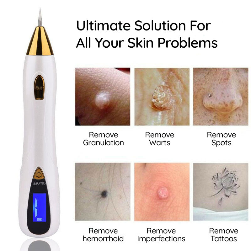 Mole Remover Pen At Home Skin Tag Removal Painless Fast