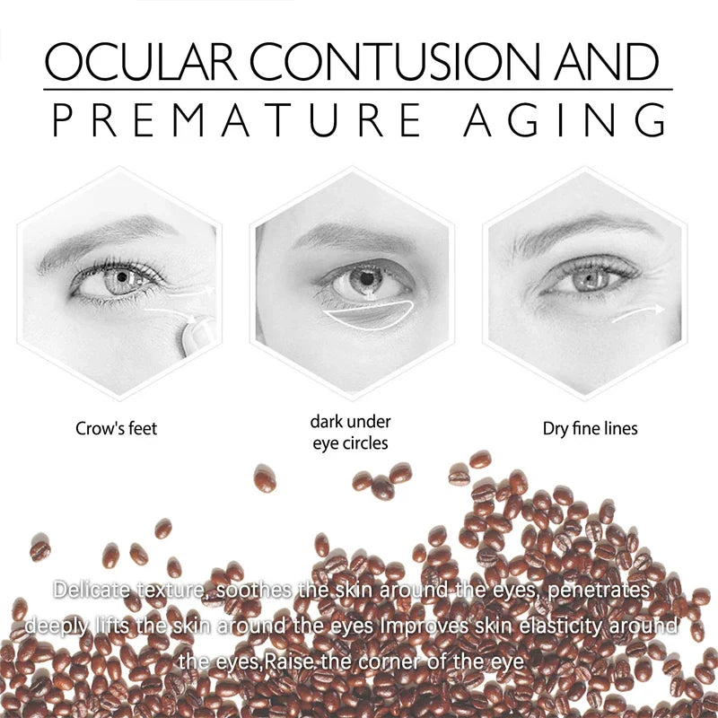 Retinol Eye Bag Removal Cream – Anti-Wrinkle Firming Dark Circle Puffiness Eye Gel Skin Care 2026
