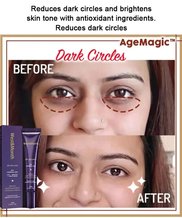 Retinol Eye Bag Removal Cream – Anti-Wrinkle Firming Dark Circle Puffiness Eye Gel Skin Care 2026
