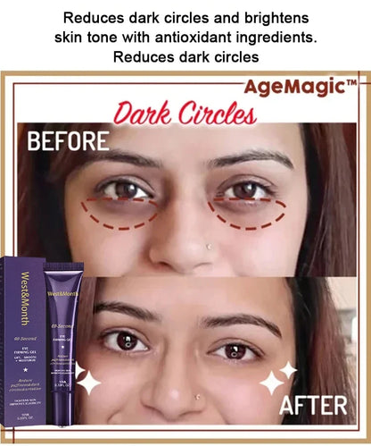 Retinol Eye Bag Removal Cream – Anti-Wrinkle Firming Dark Circle Puffiness Eye Gel Skin Care 2026