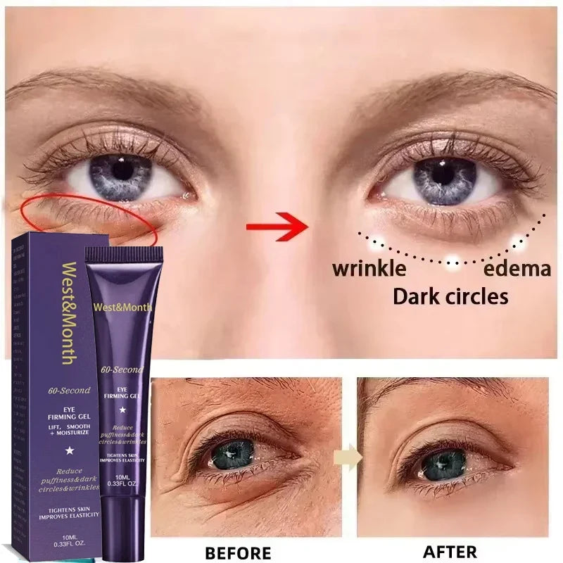 Retinol Eye Bag Removal Cream – Anti-Wrinkle Firming Dark Circle Puffiness Eye Gel Skin Care 2026