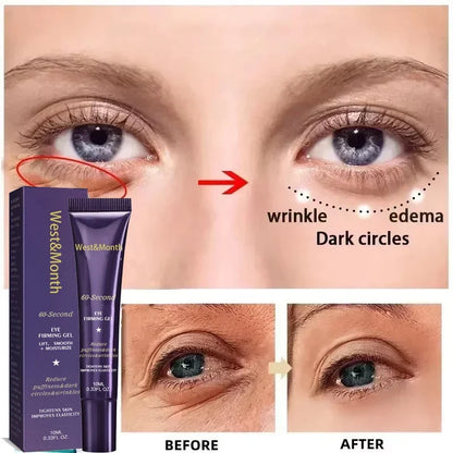 Retinol Eye Bag Removal Cream – Anti-Wrinkle Firming Dark Circle Puffiness Eye Gel Skin Care 2026