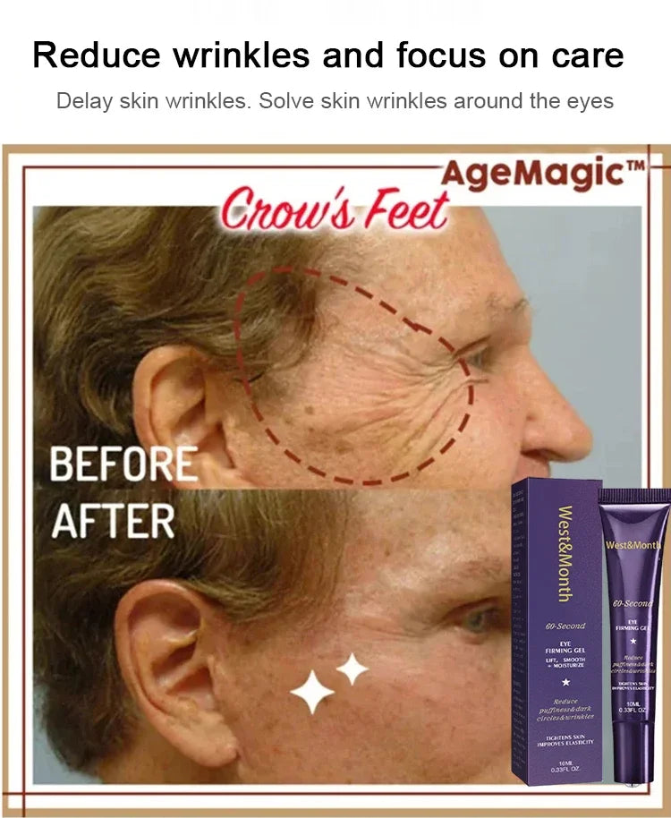 Retinol Eye Bag Removal Cream – Anti-Wrinkle Firming Dark Circle Puffiness Eye Gel Skin Care 2026