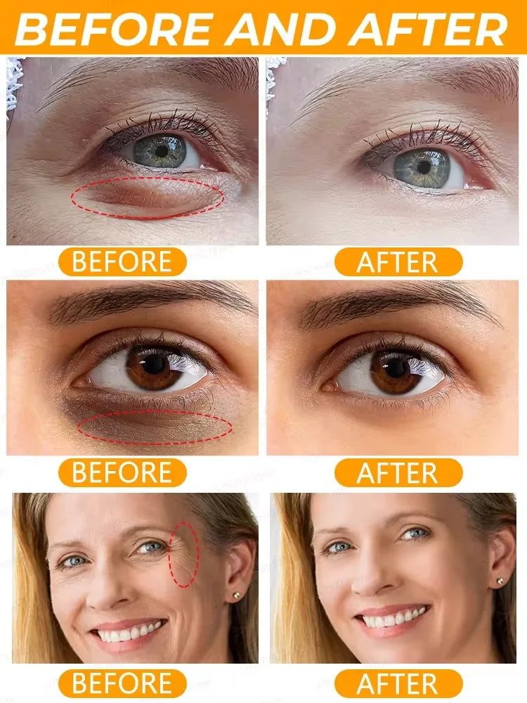 Retinol Eye Bag Removal Cream – Anti-Wrinkle Firming Dark Circle Puffiness Eye Gel Skin Care 2026
