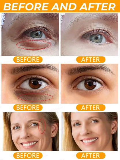 Retinol Eye Bag Removal Cream – Anti-Wrinkle Firming Dark Circle Puffiness Eye Gel Skin Care 2026
