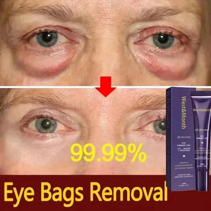 Retinol Eye Bag Removal Cream – Anti-Wrinkle Firming Dark Circle Puffiness Eye Gel Skin Care 2026