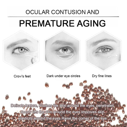 Retinol Eye Bag Removal Cream – Anti-Wrinkle Firming Dark Circle Puffiness Eye Gel Skin Care 2026