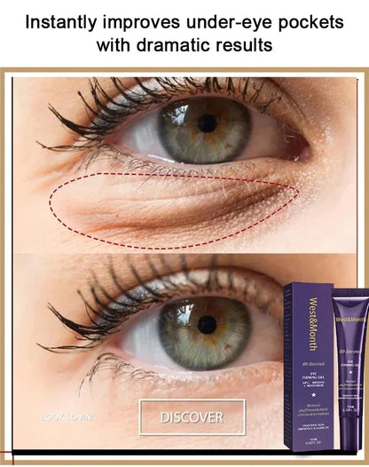 Retinol Eye Bag Removal Cream – Anti-Wrinkle Firming Dark Circle Puffiness Eye Gel Skin Care 2026