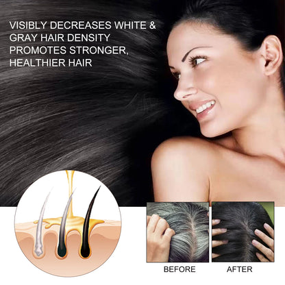 Bamboo Charcoal Shampoo Soap Bar 60g – Deep Scalp Cleanse Oil Control Hair Nourishing TikTok Viral 2026