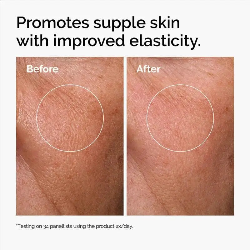 Hyaluronic Acid Serum With Ceramides - Hydrating Face Serum For Sensitive Skin, Fall 2026 Glow