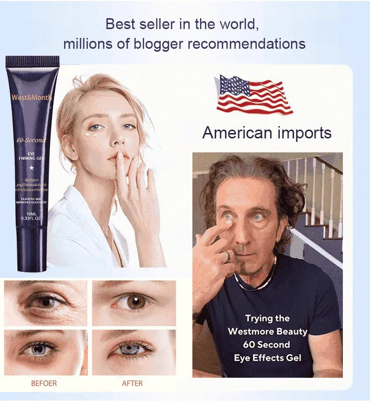Retinol Eye Bag Removal Cream – Anti-Wrinkle Firming Dark Circle Puffiness Eye Gel Skin Care 2026