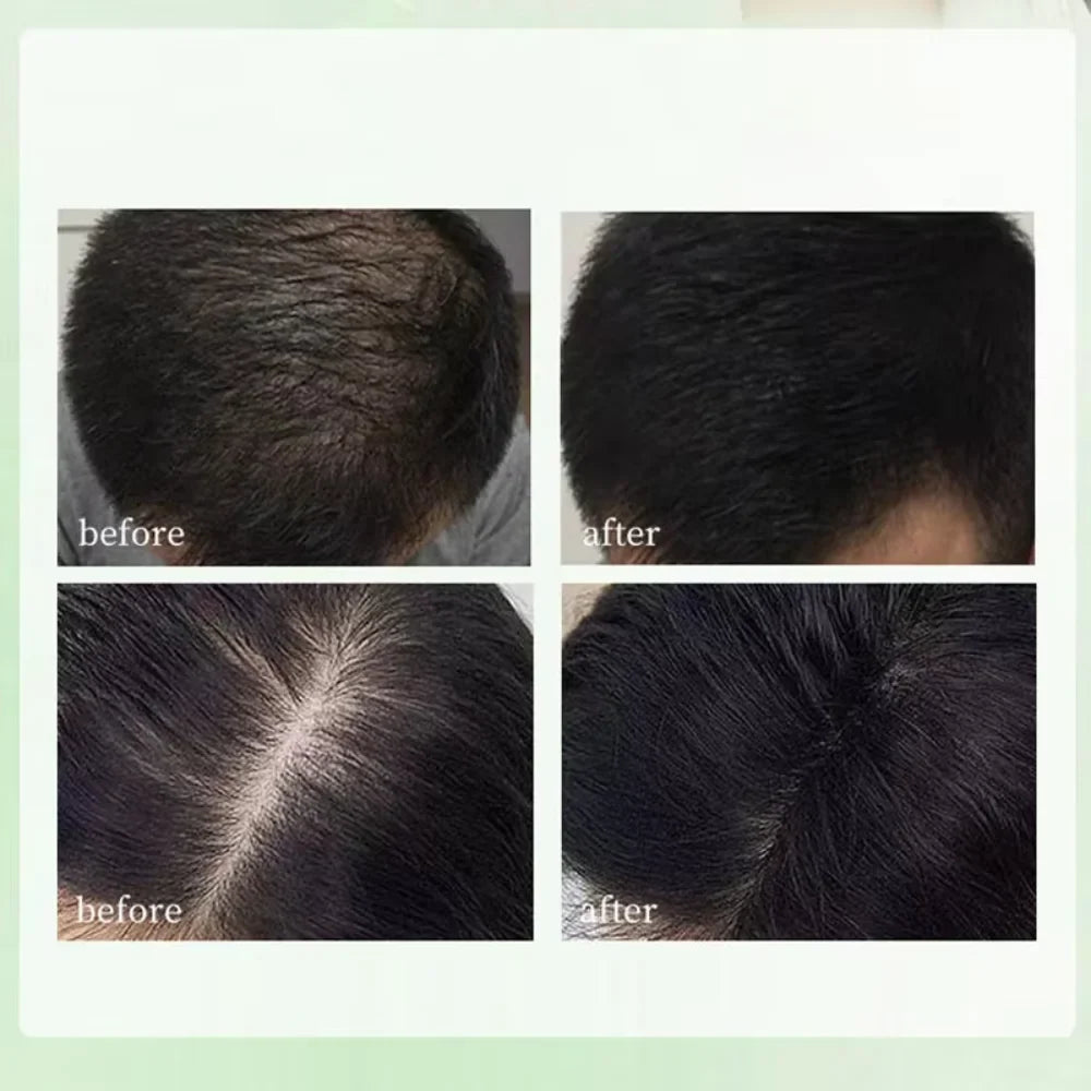 Herbal Shampoo Soap Handmade Hair Care for All Hair Types Oil Control Refreshing Fall 2026 Trend