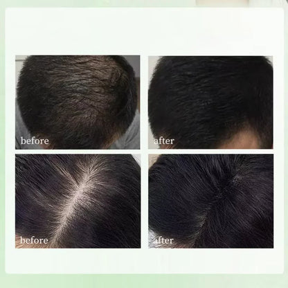 Herbal Shampoo Soap Handmade Hair Care for All Hair Types Oil Control Refreshing Fall 2026 Trend
