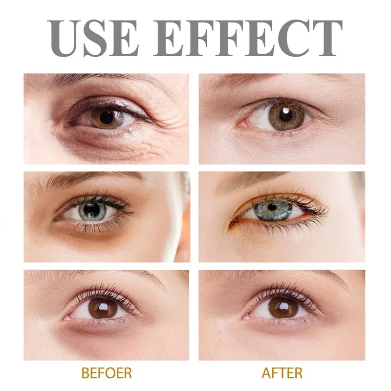 Retinol Eye Bag Removal Cream – Anti-Wrinkle Firming Dark Circle Puffiness Eye Gel Skin Care 2026