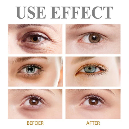 Retinol Eye Bag Removal Cream – Anti-Wrinkle Firming Dark Circle Puffiness Eye Gel Skin Care 2026