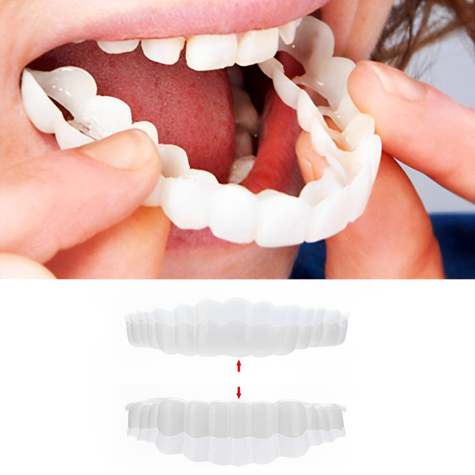 Smile Veneers Upper And Lower Instant Cover For All Day