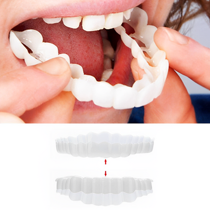 Smile Veneers Upper And Lower Instant Cover For All Day