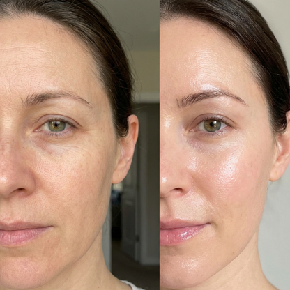 PDRN Pink Collagen Volume Multi Balm