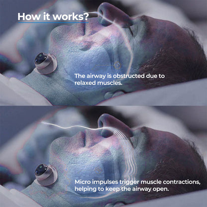 Anti Snore Device Chin Clip Sleep Aid For Quiet Nights