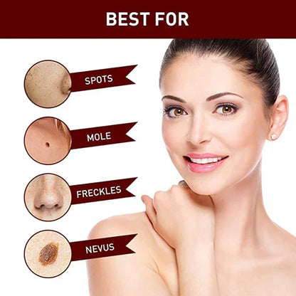 Skin Tag Mole Remover Pen With Tea Tree Oil Fast Home