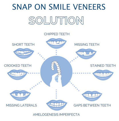 Smile Veneers Upper And Lower Instant Cover For All Day