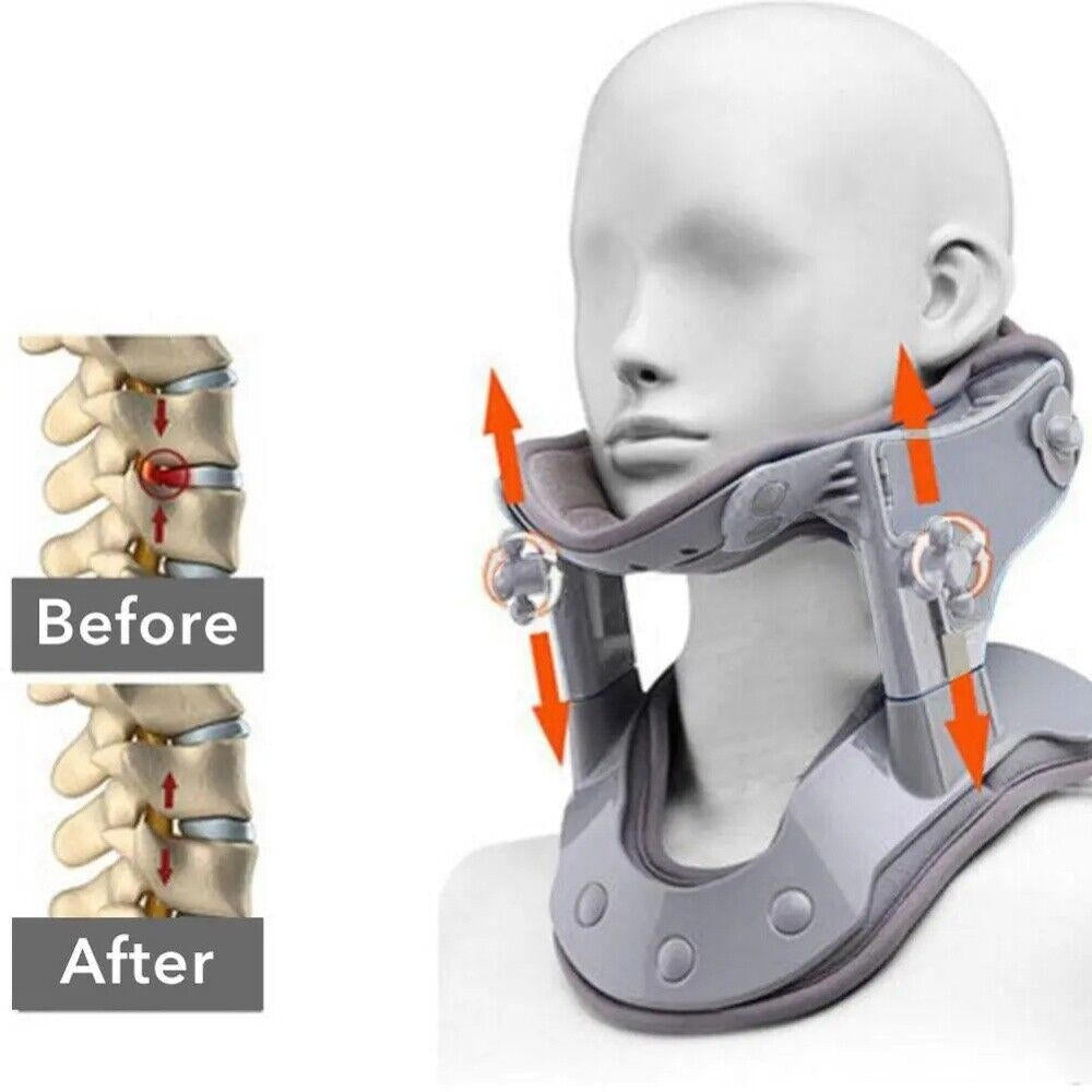 Neck Traction Device – Airbag Heat Therapy Decompression, Fall 2025 Pain Relief